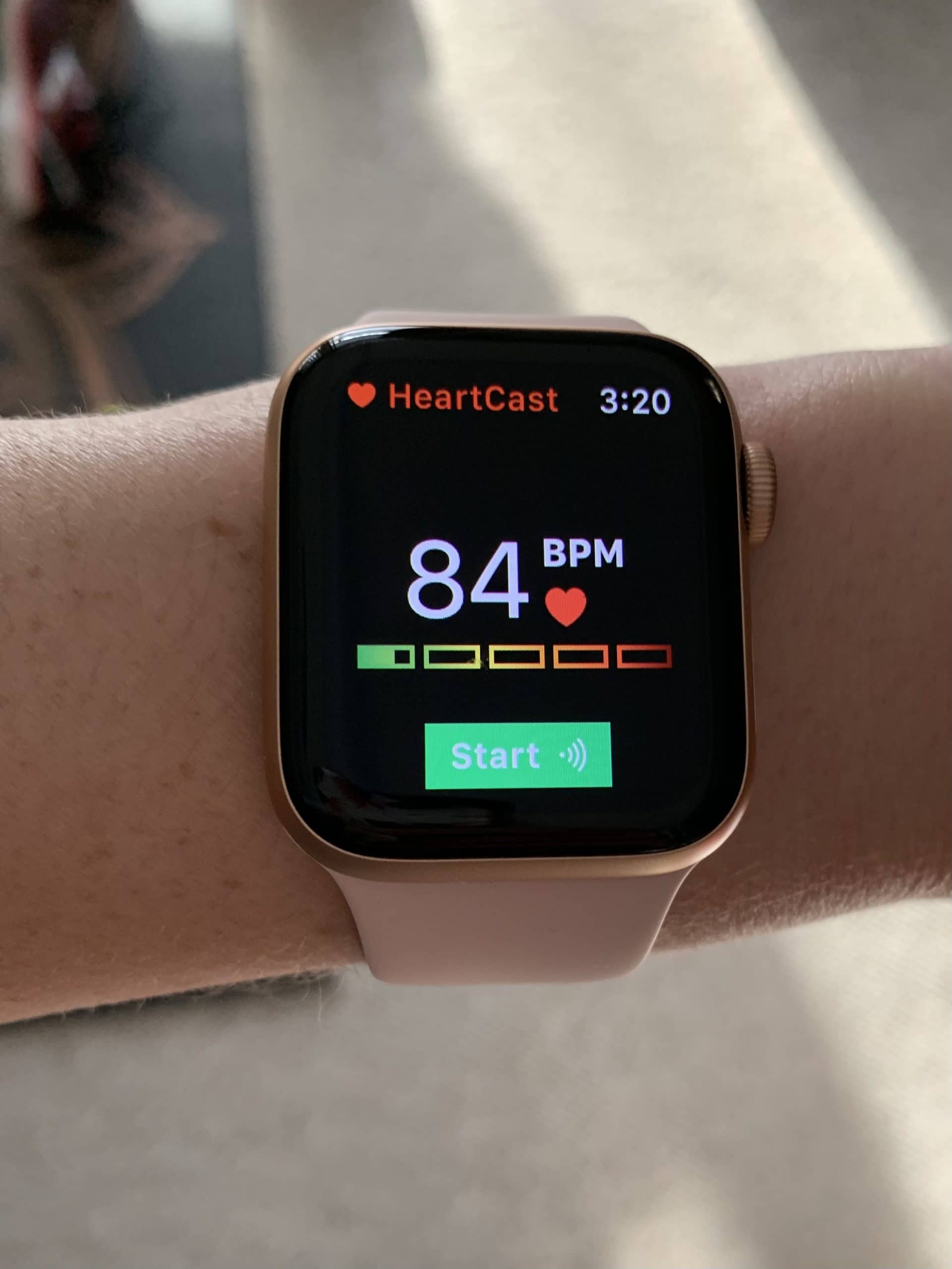 apple watch heartcast scaled