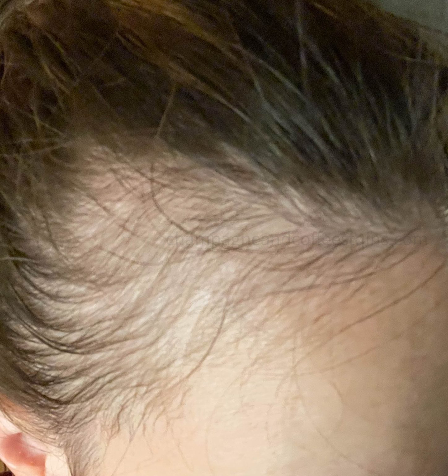 I Tried Divi Hair Serum for 4 Months and Here's What Happened (with pics)